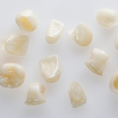 Multiple all ceramic dental crowns in River Ridge