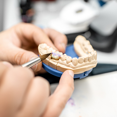 Working on inlays and onlays on model of teeth
