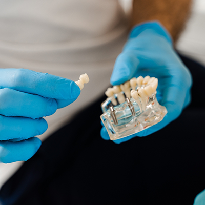 Holding dental bridge in River Ridge and model of dental implants