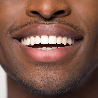 Close up of man smiling after full mouth reconstruction in River Ridge