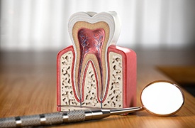 Model of anatomy of a tooth next to dental mirror