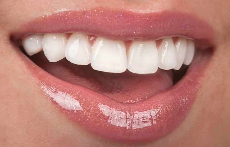 Tooth Filling, Veneers, or Dental Bonding?
