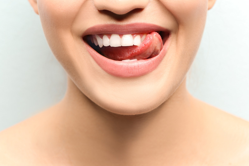 Patient smiling with dental fillings